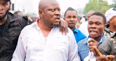 RDC : Fayulu, Sessanga, Kabund blessés lors du sit-in de l&rsquo;opposition