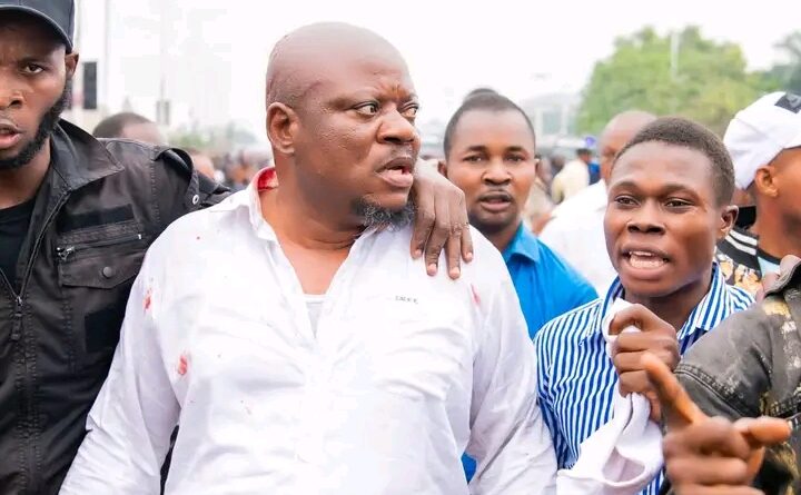 RDC : Fayulu, Sessanga, Kabund blessés lors du sit-in de l&rsquo;opposition